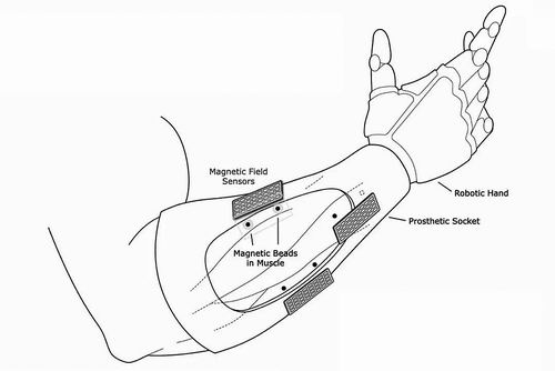 美国开发出一种控制假肢的新方法名为磁微测量法
